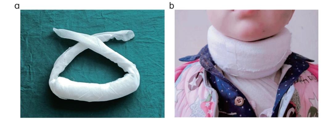 Improvised gauze cervical collar on a child